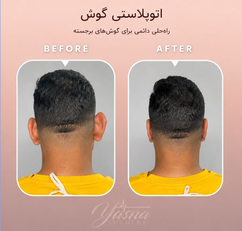 تخصص و تجربه در جراحی گوش