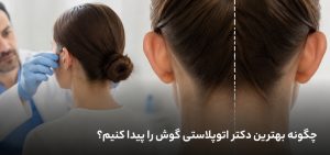 چگونه بهترین دکتر اتوپلاستی گوش را پیدا کنیم؟