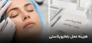هزینه عمل بلفاروپلاستی در ۱۴۰۵