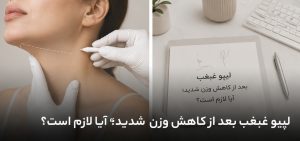 لیپو غبغب بعد از کاهش وزن شدید؛ آیا لازم است؟